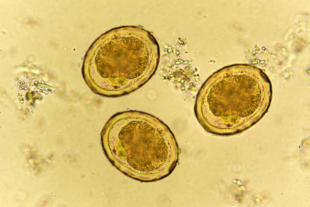 Parásito intestinal, Ascaris, bajo un microscopio. (jarun011 / Adobe Stock)
