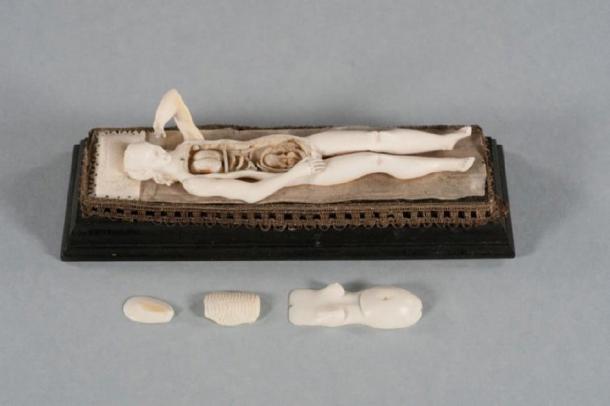 This is an Ivory manikin after removal of the abdominal and chest wall, ribs, and part of the uterus. Internal organs such as the lungs, intestines, as well as a fetus inside the uterus are visible. (RSNA)