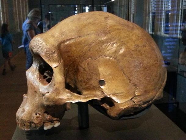 The Kabwe skull, or Broken Hill skull, with its bullet-like hole clearly visible on the site, on display in the National History Museum in London. (Jonathan Cardy / CC BY-SA 3.0)
