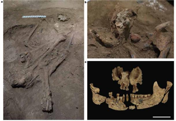 Características funerarias de Liang Tebo del amputado de Borneo, Indonesia, en el 29.000 a.C. AD: a) Un entierro de un solo adulto (TB1); el cráneo está a la derecha de la barra de escala; b) nódulo in situ de color rojo ocre (pigmento natural de la tierra) junto a la mandíbula; c) Maxilar y mandíbula. Barra de escala, 5 centímetros o 2 pulgadas. (Maloney, et al./Naturaleza)