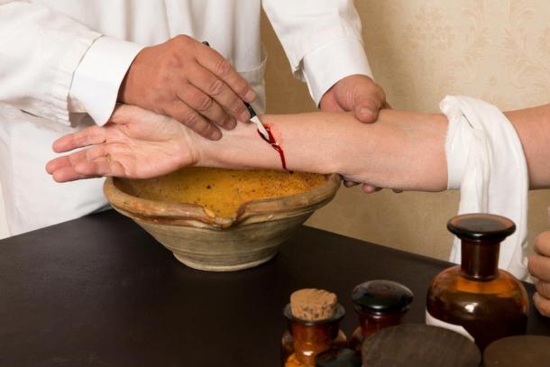 In medieval times and even before bloodletting was believed to get the bad out and this was also true of the plague and after the plague! (Anneke / Adobe Stock)