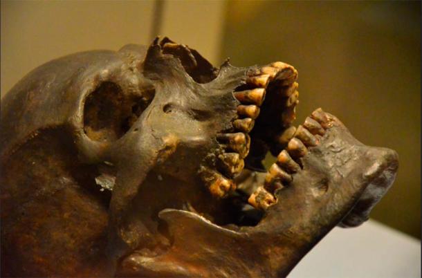 Teeth of Gristhorpe Man (Ben Sutherland/CC BY 2.0)