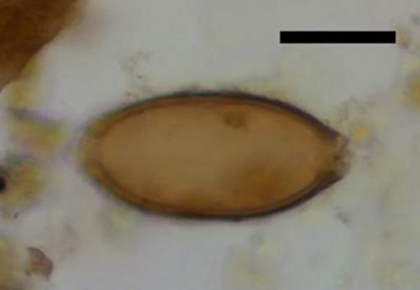 Microscopic whipworm egg from Çatalhöyük, Turkey. The black scale bar represents 20 micrometers