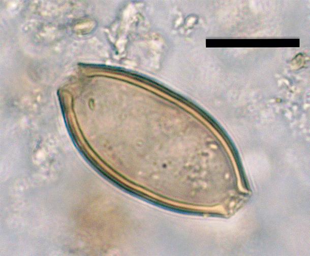 Huevo microscópico de tricocéfalo del orinal. La barra de escala negra representa 20 micrómetros. (Sophie Rabinow/Revista de Ciencias Arqueológicas)