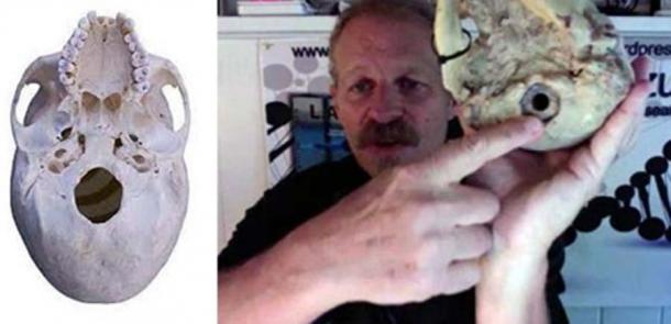 Left: Modern skull foramen. Right: L.A Mazulli points out foramen magnum on Paracas skull. (soul-guidance.com)