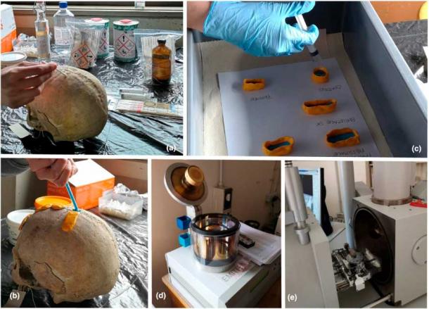Molding and casting process of skull CT1953 which included evidence of medieval brain surgery. (Ileana Micarelli et al / Wiley)