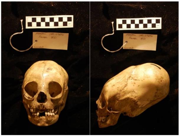 Morton Collection, Skull #1681