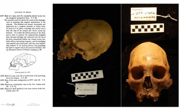 Колекция Morton, череп # 1277