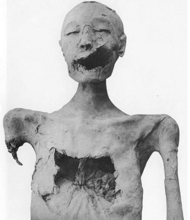 Mummy of the Younger Lady