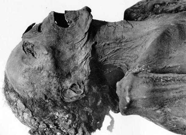 Mummy of the Unknown Man E (“The Screaming Mummy”) found in DB320, maybe the prince Pentawer, a son of pharaoh Ramesses III of the 20th dynasty