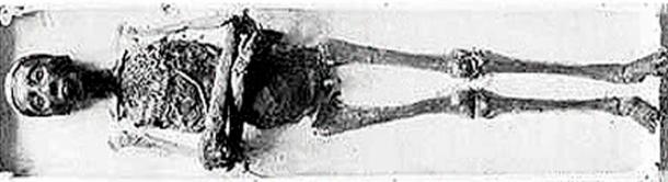 Mummy of Tutankhamun. (Howard Carter/ Public domain)