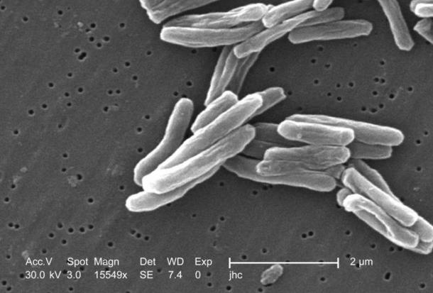 Mycobacterium tuberculosis germs 
