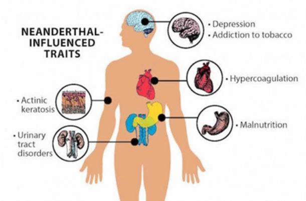 Neanderthal genes have been connected to many health issues in modern humans. 