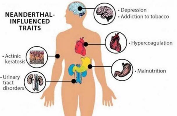 Neanderthal genes have been connected to many health issues in modern humans.