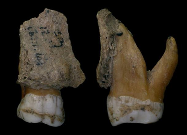 Neanderthal teeth from Spy with dental calculus deposit seen as the rind layer on tooth enamel. Royal Belgian Institute of Natural Sciences, Author provided