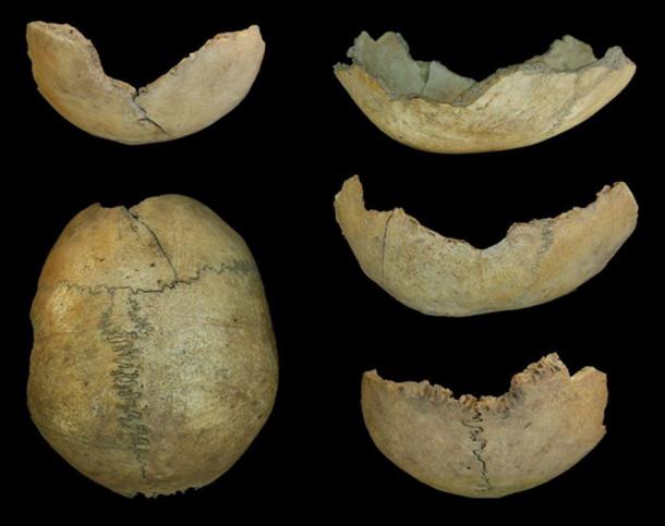 Human Skull ‘Cups’ and Butchered Bones Lead Archaeologists to One ...