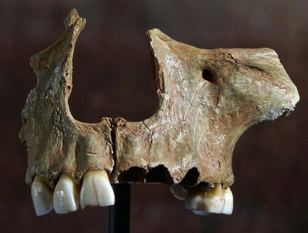 Partial skull found at Gough's Cave, Somerset, England. Facial Remains showing cutting-marks, where the meat has been removed, a clear sign of cannibalism. 
