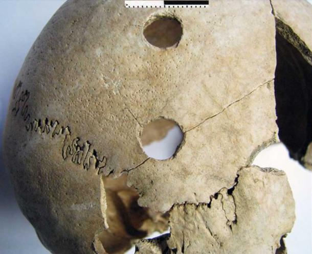 Heridas penetrantes en el lado derecho del cráneo de una mujer adulta joven de la masacre de Potočani. (Prof. Mario Novak / Instituto de Investigaciones Antropológicas)