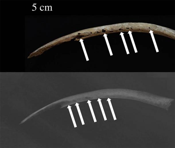 Photograph (above) and X-ray (below) of the rib shaft of the ancient Bronze Age man showing osteolytic lesions. (Jenna Dittmar / Science Direct)