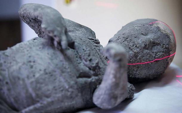Ancient Pompeii Victims Reveal Great Teeth and Good Health