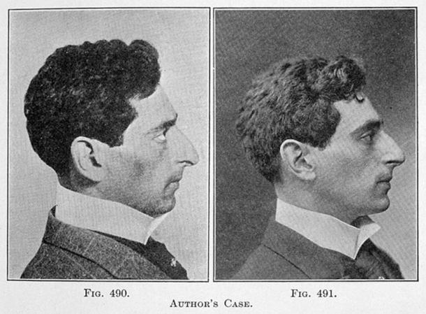 From the book 