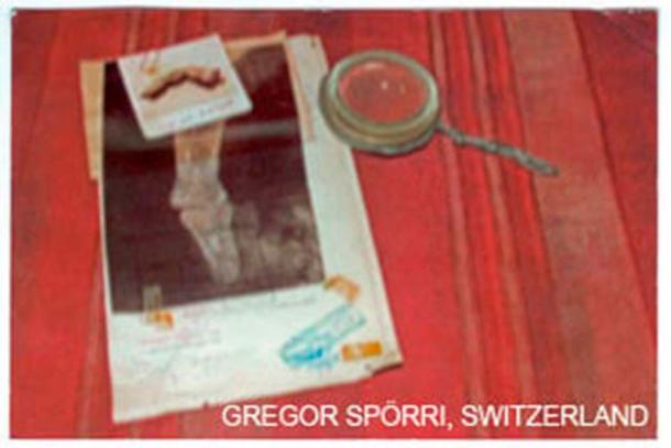 A Polaroid photo of the finger and an X-ray made in the 1960s (Courtesy of ©Gregor Sporri)