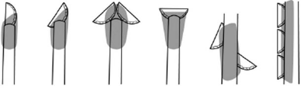 Possible hafting modes of Uluzzian backed pieces based on the distribution of residue. (Nature Ecology & Evolution)
