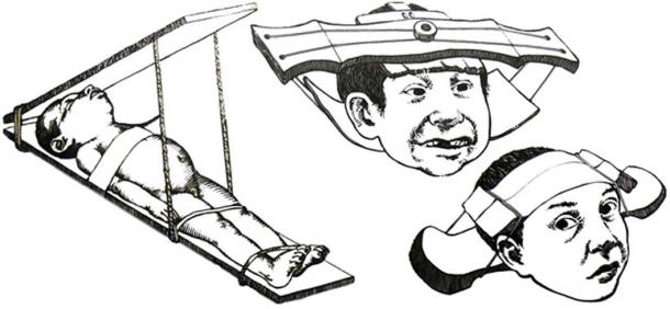 Possible methods used by the Collagua people to shape a child's head.