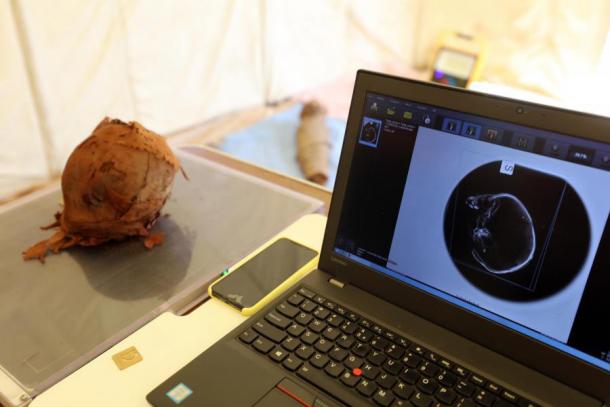 Análisis radiológico de la cabeza de un niño momificado procedente de la tumba grecorromana de Asuán Occidental, realizado con un aparato de rayos X portátil. (Misión Egipcio-Italiana (EIMAWA))