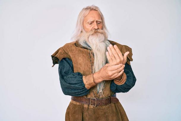 Representational image of Viking male suffering from Viking’s disease, also known as Dupuytren’s disease. (Krakenimages.com / Adobe Stock)