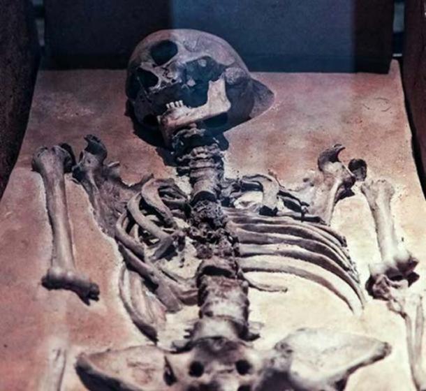 Representative image of an old skeleton. (Public Domain/Detail)