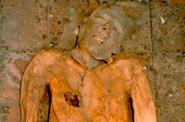 Researchers reconstructed the E. coli genome using fragments from an infected gallstone found in this 16th-century Italian nobleman’s mummy remains. (University of Pisa’s Paleopathology Department)