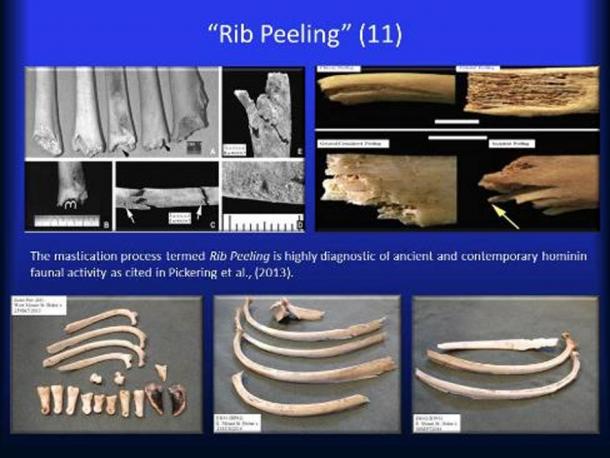 Rib Peeling.