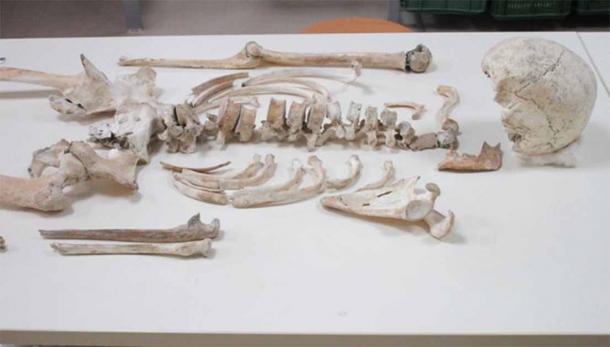 Los científicos pudieron secuenciar el genoma completo del hombre de Pompeya utilizando sus restos óseos. (Serena Viva)