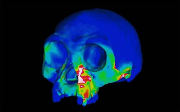 Screenshot from a computer simulation of Homo floresiensis (a.k.a. the Hobbit) cranium during biting. (Ledogar lab / Duke University)