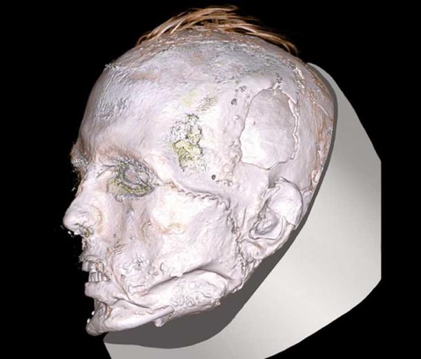 The Scythian warrior’s face, showing a scar from his left eye socket to his jaw. 