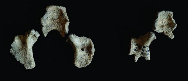 Left: Segments of the occipital bone from fetus 1. Right: Segments of the occipital bone from fetus 2. 