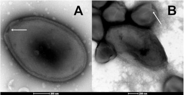 The 48,500-year-old Siberian virus is a pandoravirus, which infects single-cell organisms known as amoebas. (Claverie et. al / bioRxiv)