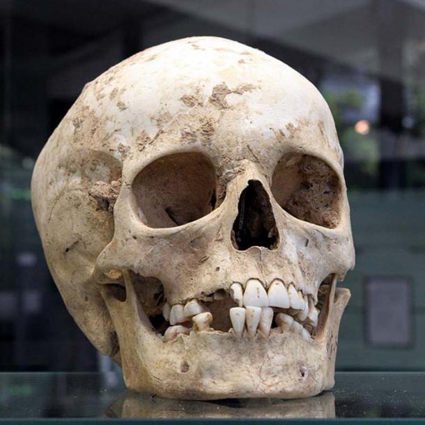 Skull found in the archaeological site of Herxheim.