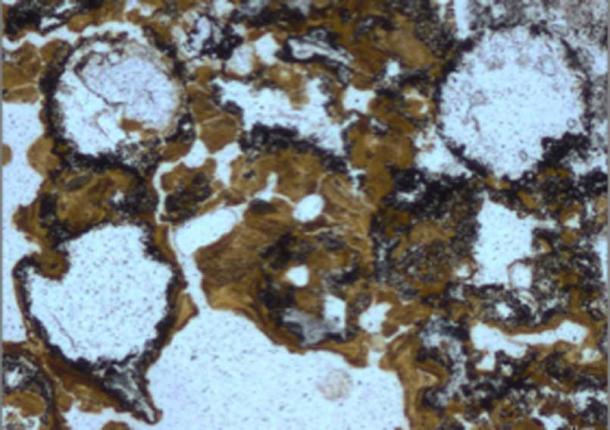 Spherical bubbles preserved in 3.48 billion-year-old rocks in the Dresser Formation in the Pilbara Craton in Western Australia provide evidence for early life having lived in ancient hot springs on land. (UNSW)