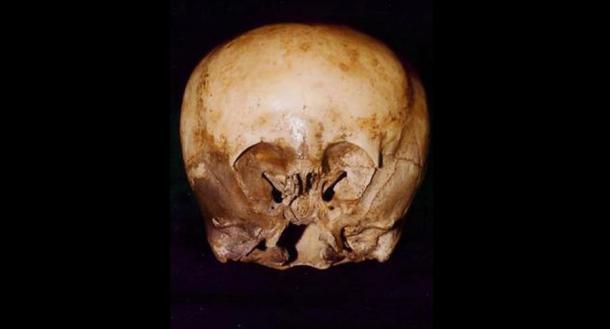 El cráneo de Starchild se descubrió por primera vez en México. (Uso justo)