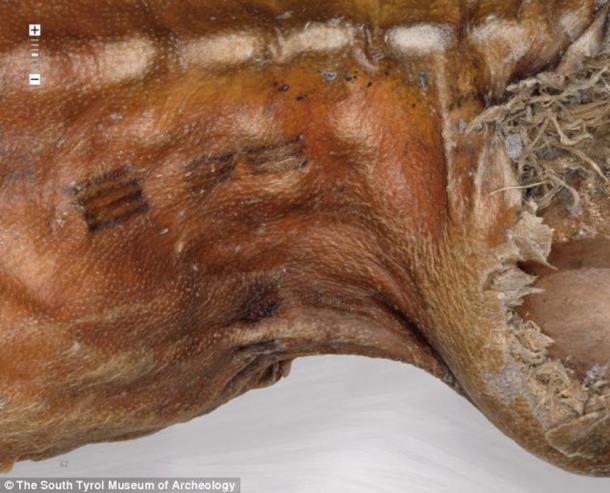 Tatuajes encontrados en el cuerpo de Otzi the Iceman. Crédito: Museo de Arqueología de Tirol del Sur