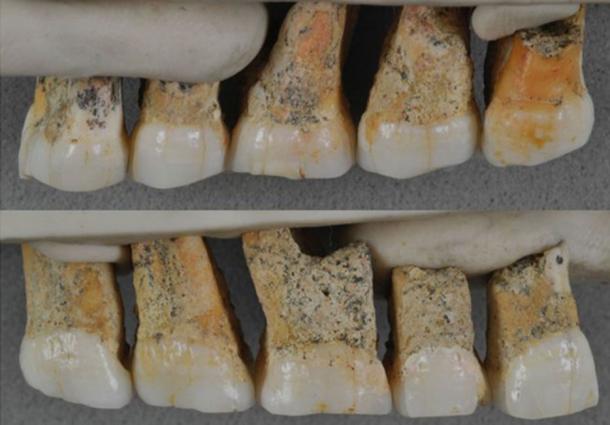 Teeth of Homo luzonensis found – evidence of the new species of human. (Florent Détroit / © Callao Cave Archaeology Project)
