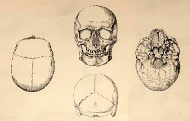 Drawings of the Gristhorpe Man's Skull, J. and W.C. Williamson (Scarborough Museum's Trust)