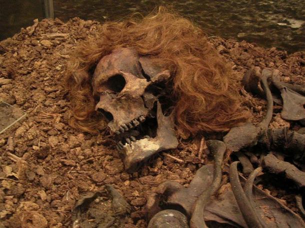 The Bocksten Man is the remains of an ancient male body found in a bog in Sweden.