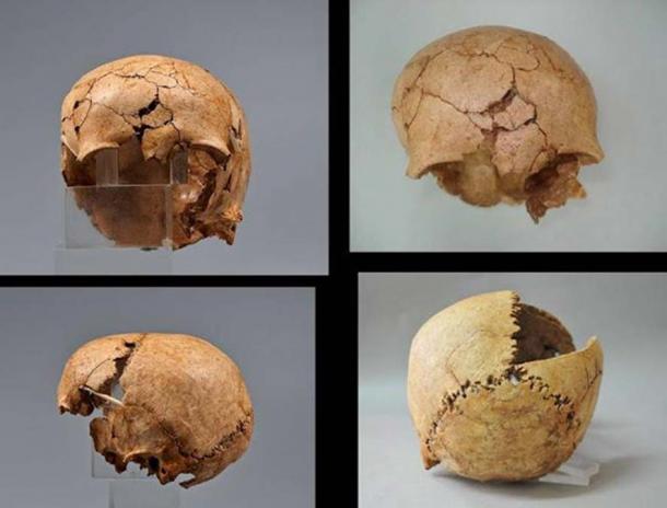 The broken skull of a young girl was found among animal skulls.