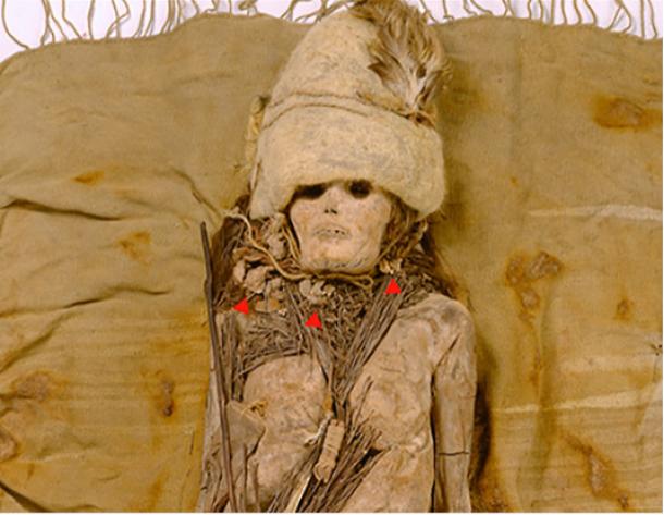 The mummified Tarim Basin girl, with the position of the cheese lumps marked. 