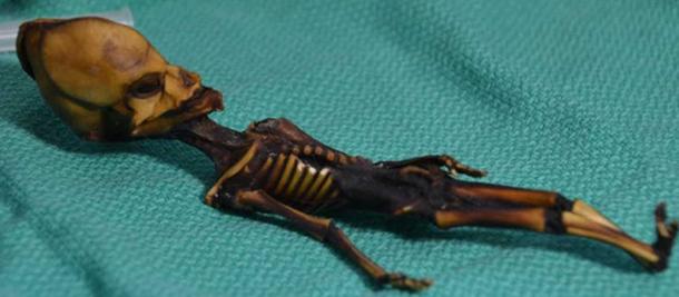 The mummified fetus from the Atacama region of Chile. Bhattacharya S et al. 2018, CC BY