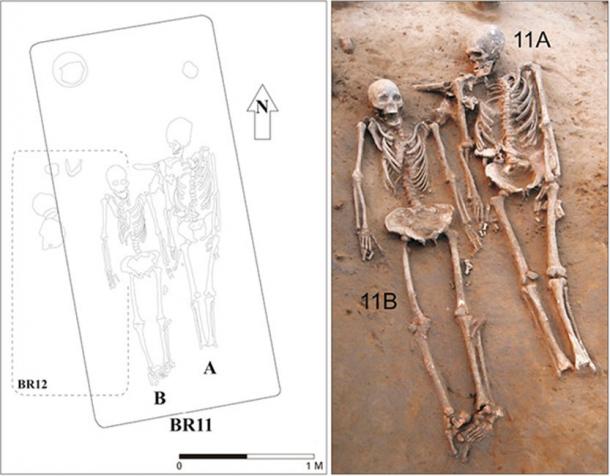 The two skeletons. Their heads were placed towards north. The foot bones on one of the skeletons was missing. (ACB Journal of Anatomy and Cell Biology)