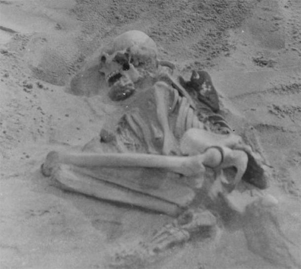 The 5,000-year-old Tiree skeleton was also buried in the fetal position. (The Hunterian)